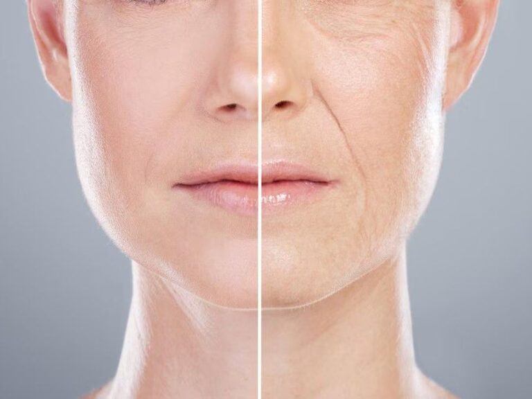 Který krém proti vráskám doporučují odborníci? Který krém proti vráskám doporučují odborníci?